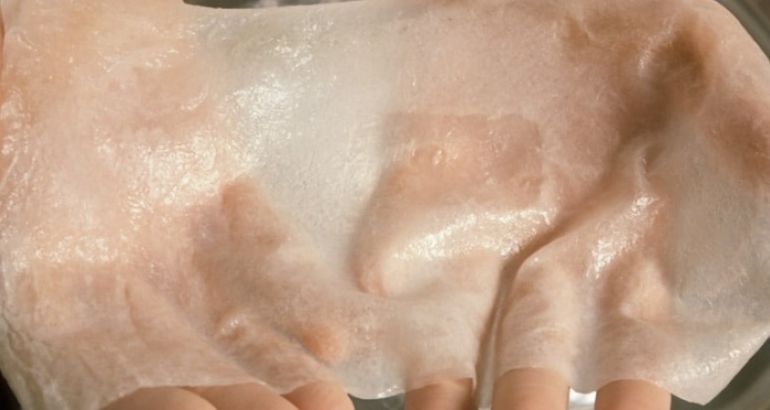 Skin Transplantation